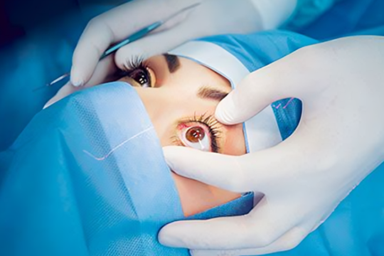 Squint Correction Surgery